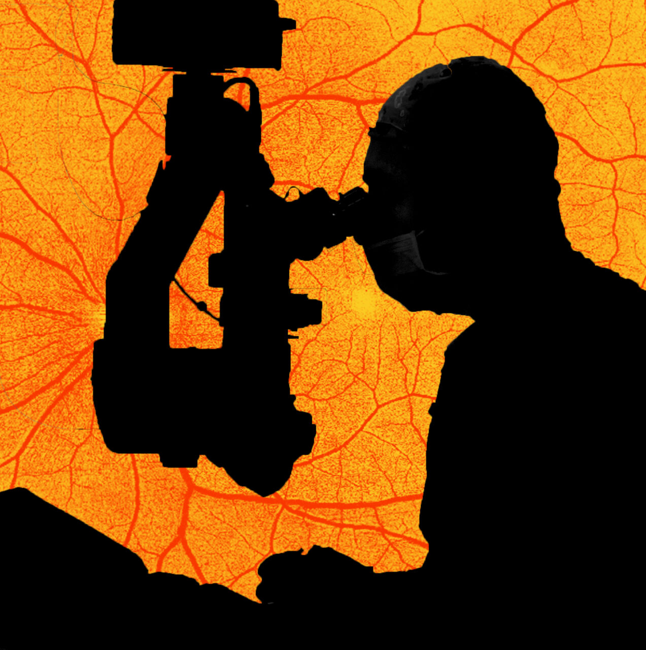 eye-surgeon-performing-retinal-surgery-image-with-retina-image-at-background
